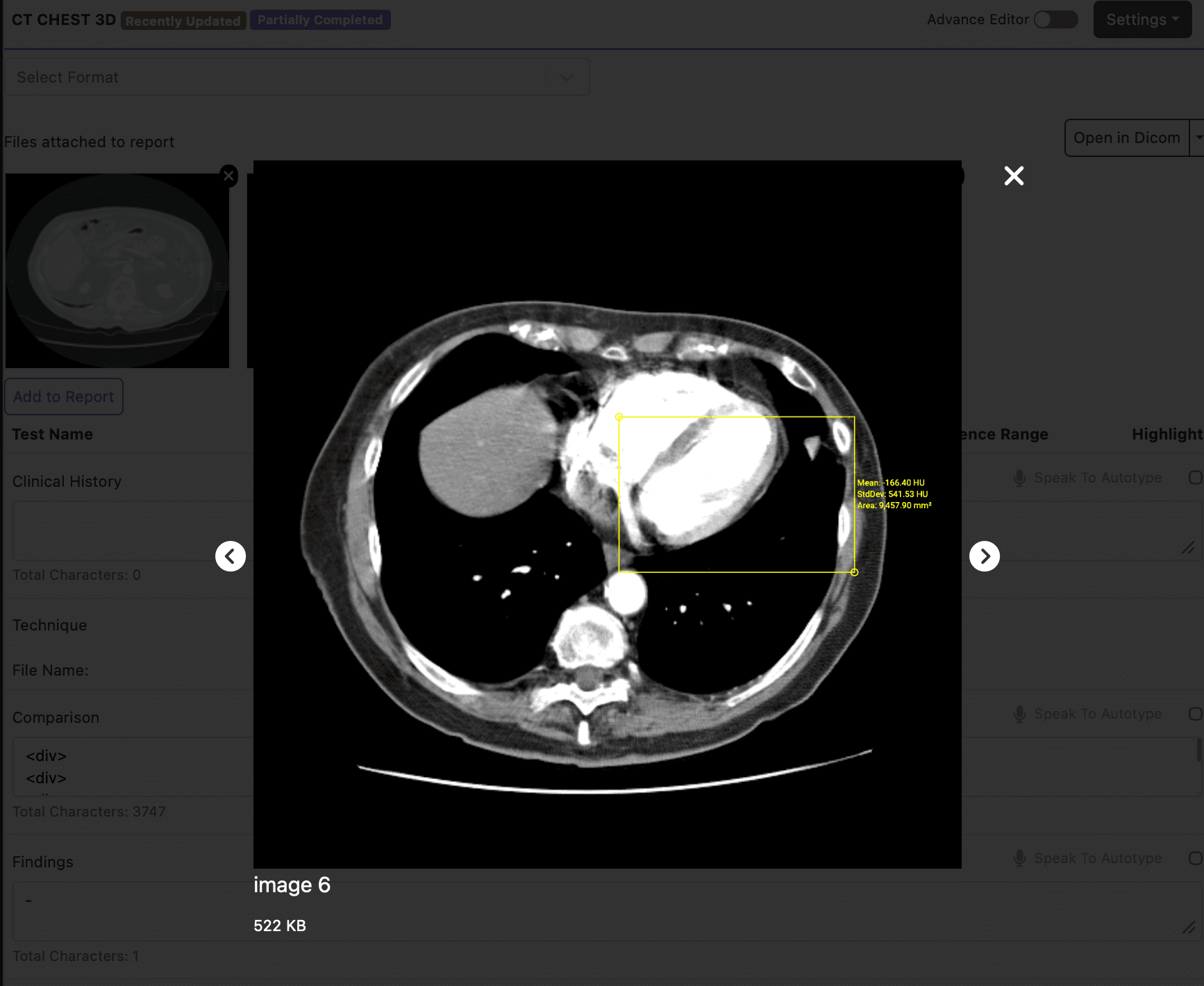 Zoomed Screenshot View