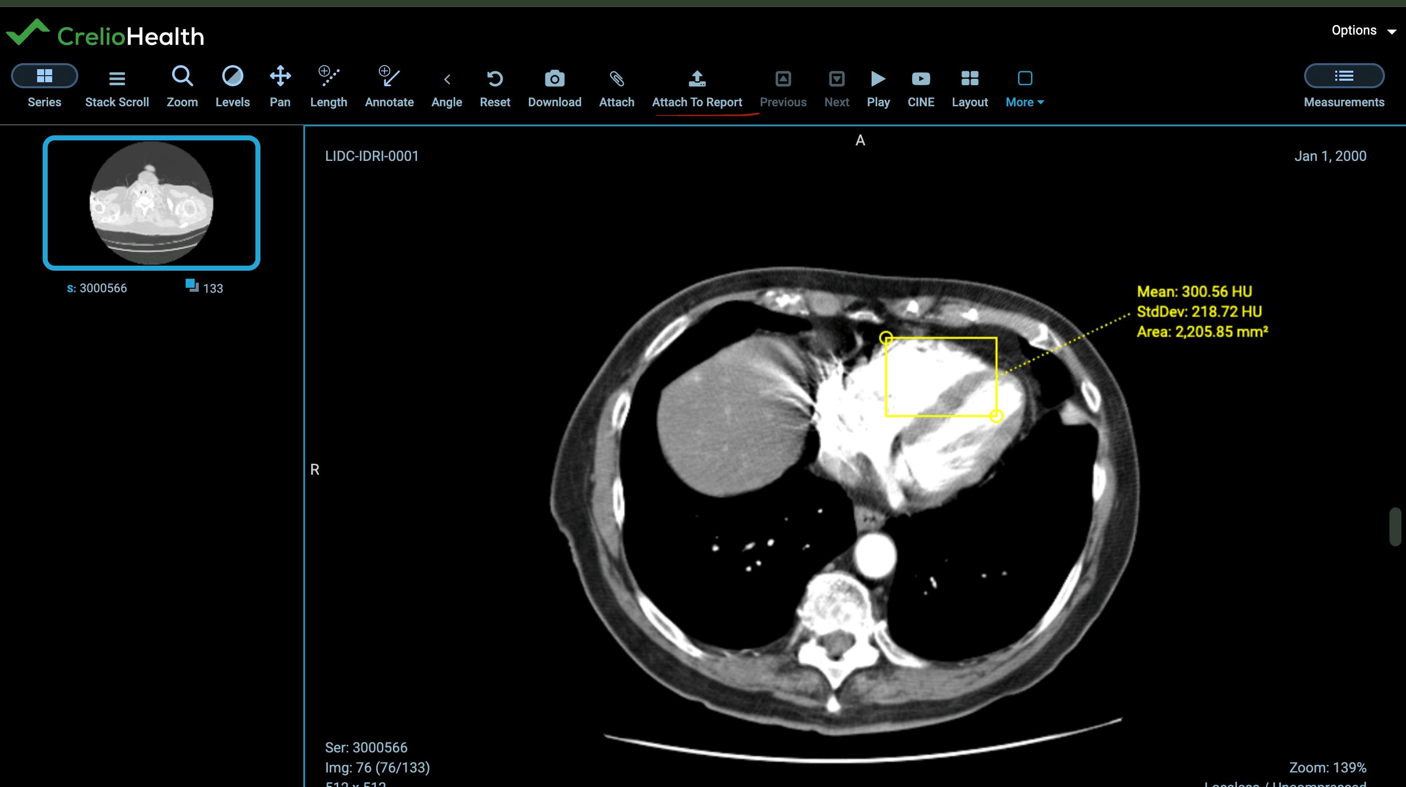 Final Report with Attached Annotations
