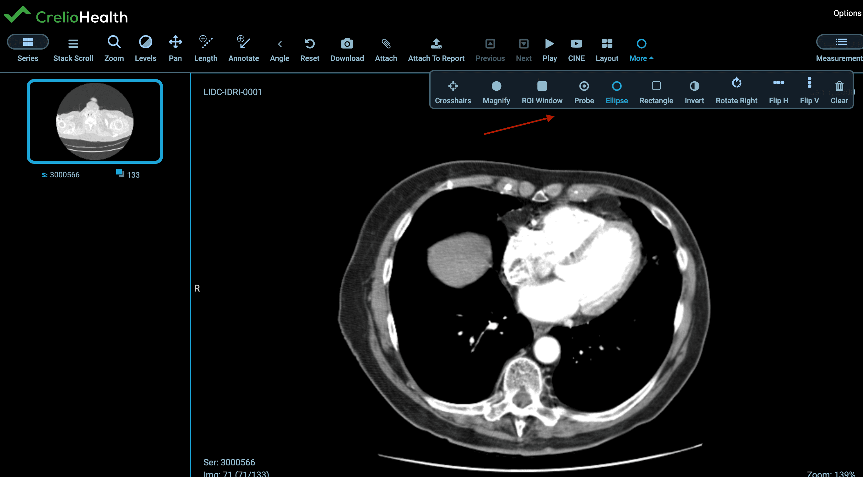 Annotation Tools Interface