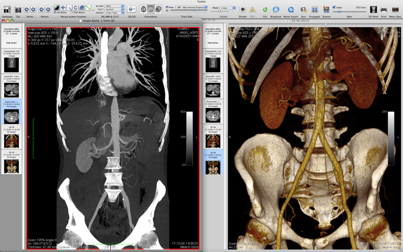 Osirix2